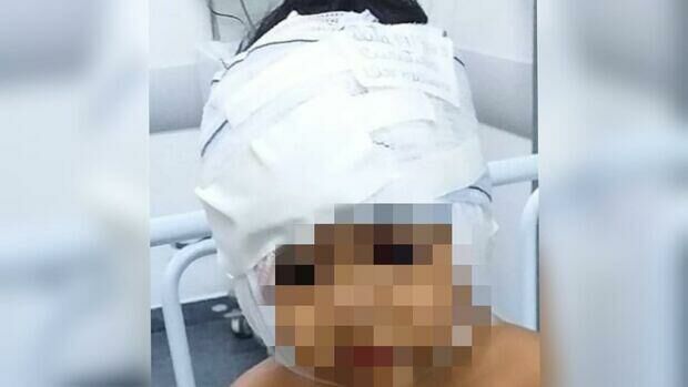 Imagem de compartilhamento para o artigo Criança que teve rosto dilacerado por Pitbull passa por cirurgia da MS Todo dia