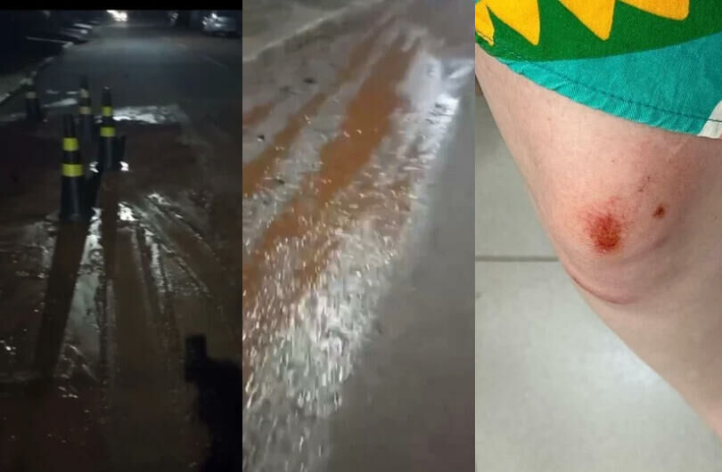Imagem de compartilhamento para o artigo Lama, descaso e risco à vida: jovem sofre acidente em rua tomada por barro deixado pelo SAAE em Costa Rica da MS Todo dia