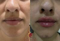 Ilustração para o assunto Estética  da MS Todo dia