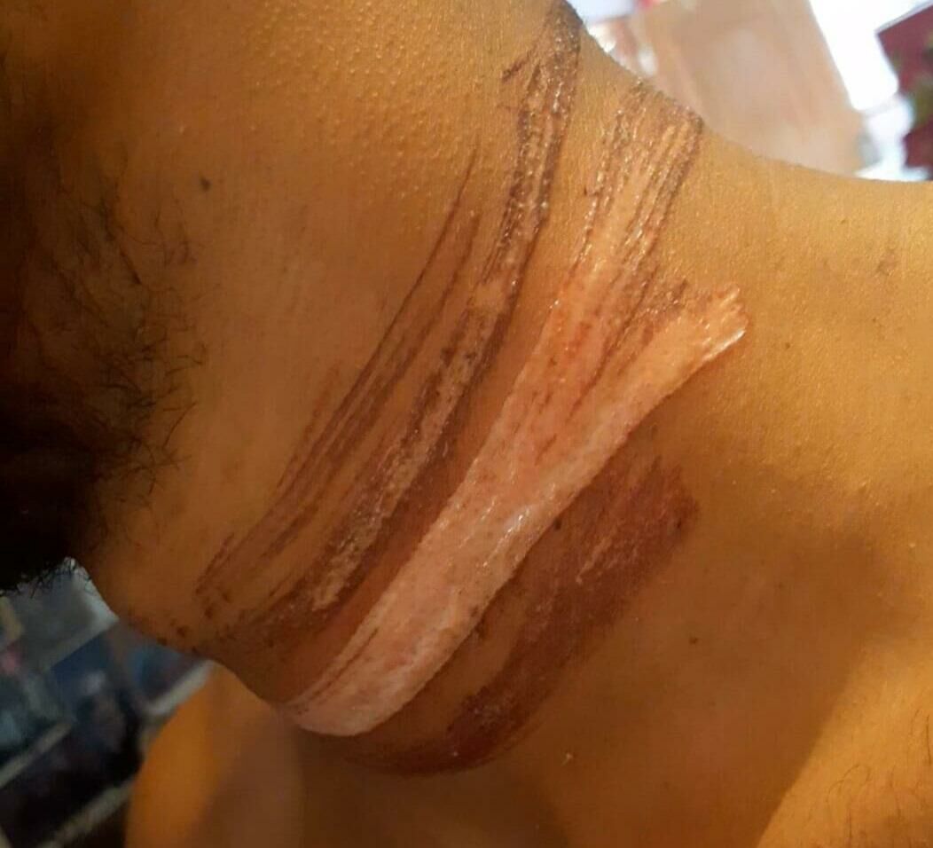 Imagem de compartilhamento para o artigo Motoentregador escapa da morte após acidente com fio de internet em Chapadão do Sul da MS Todo dia