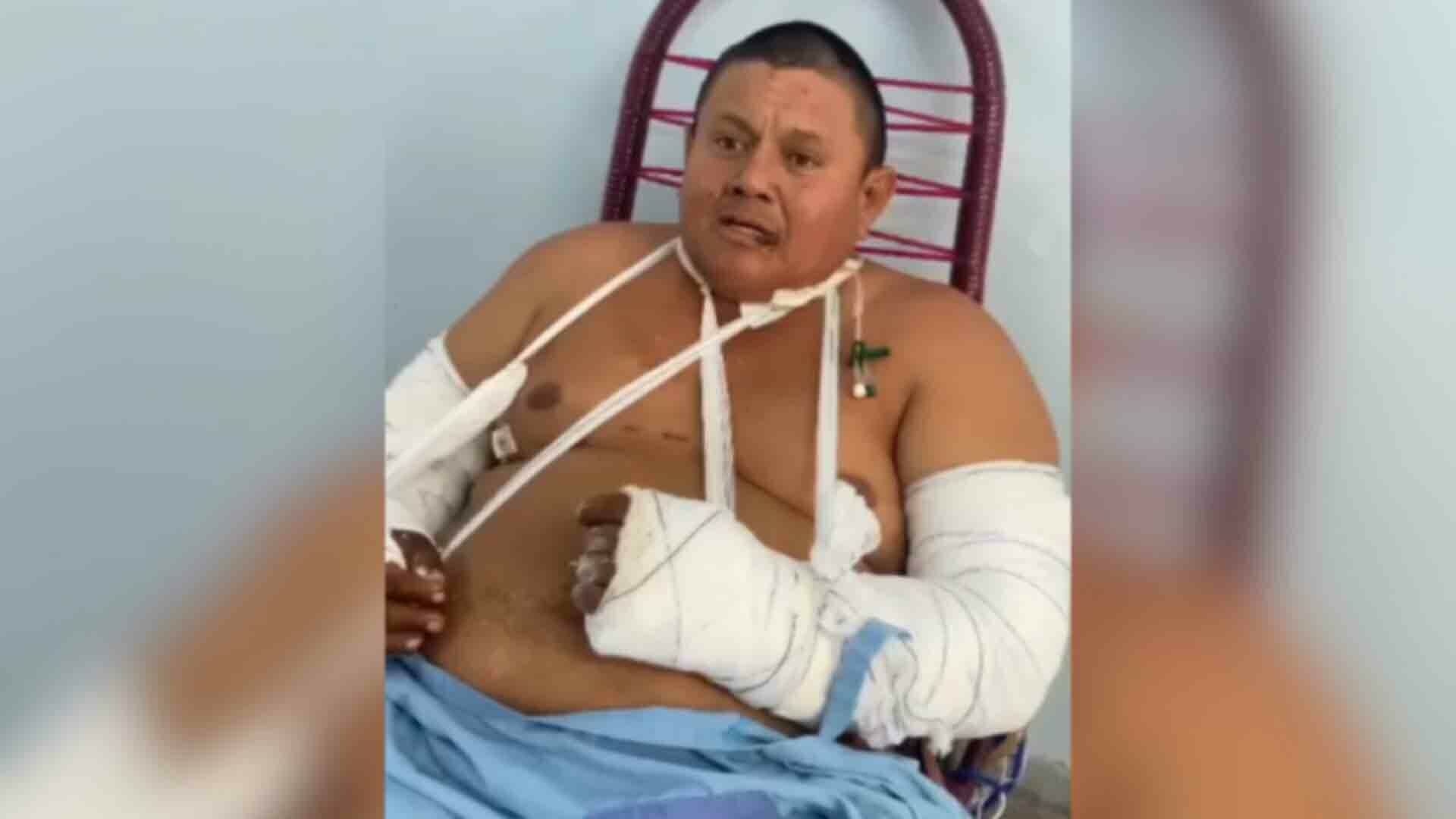 Imagem de compartilhamento para o artigo Peão atacado por onça se recupera bem e deve passar por cirurgia amanhã da MS Todo dia