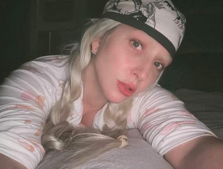 Imagem Gaga