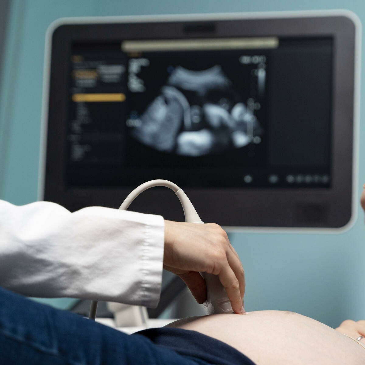 Imagem ilustrativa para o artigo Cordão Umbilical Enrolado no Pescoço do Bebê: O Que Você Precisa Saber da Genuína Conexão
