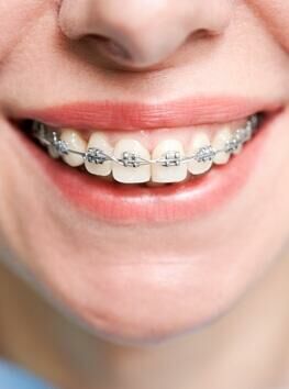 Ortodontia e Ortopedia dos Maxilares