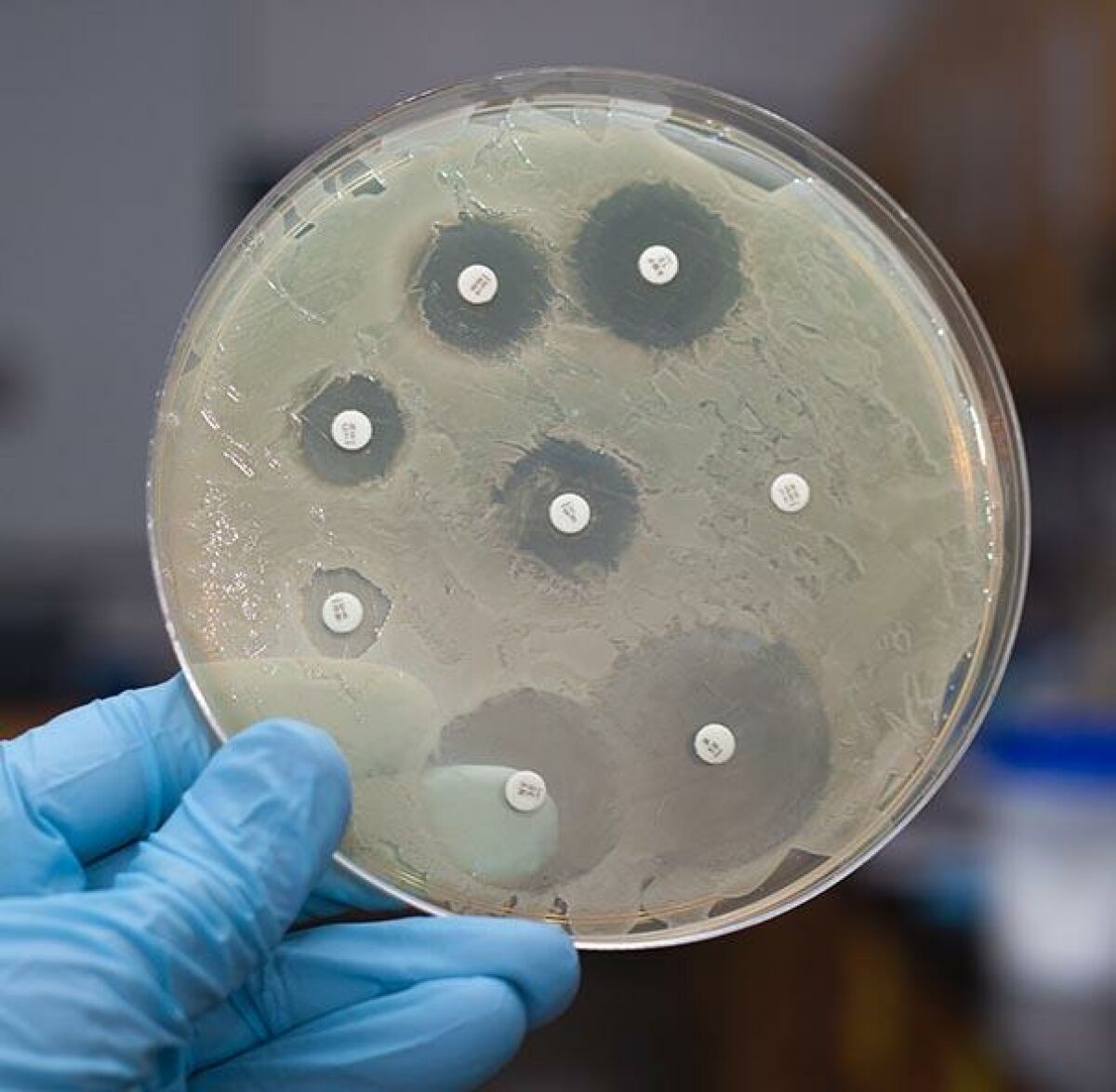 Imagem principal de Avaliação de Resistência Microbiana