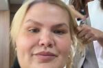 Imagem principal do artigo Thais Carla procura ajuda médica contra queda de cabelo após cirurgia bariátrica: “Se agravou no pré-cirúrgico”