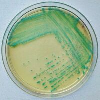 Imagem principal do artigo Detecção de Listeria Monocytogenes Indispensável na Segurança Alimentar