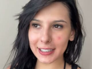 Imagem da notícia Sem maquiagem, Ana Castela mostra rosto com acne e desabafa após iniciar tratamento contra as lesões