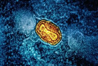Imagem da notícia Suécia confirma primeiro caso de Mpox do tipo mais grave
