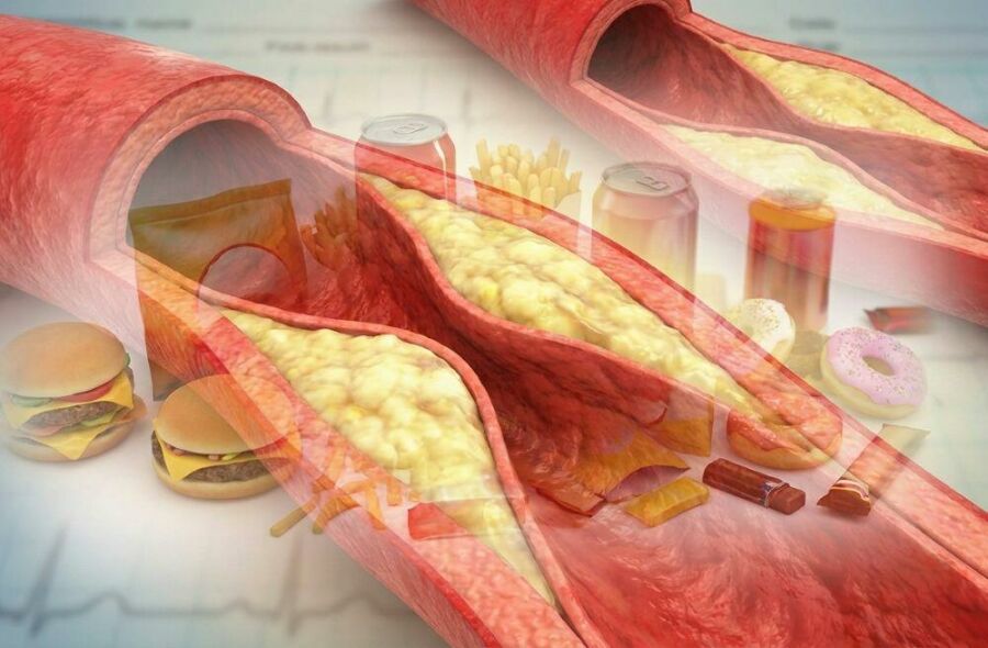 Imagem Doenças-crônicas-não-surgem-de-repente-Elas-são-construídas-refeição-após-refeição