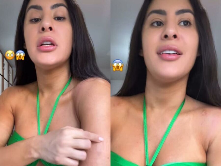 Imagem Isabelle_ferimentos