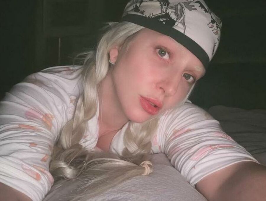 Imagem Gaga