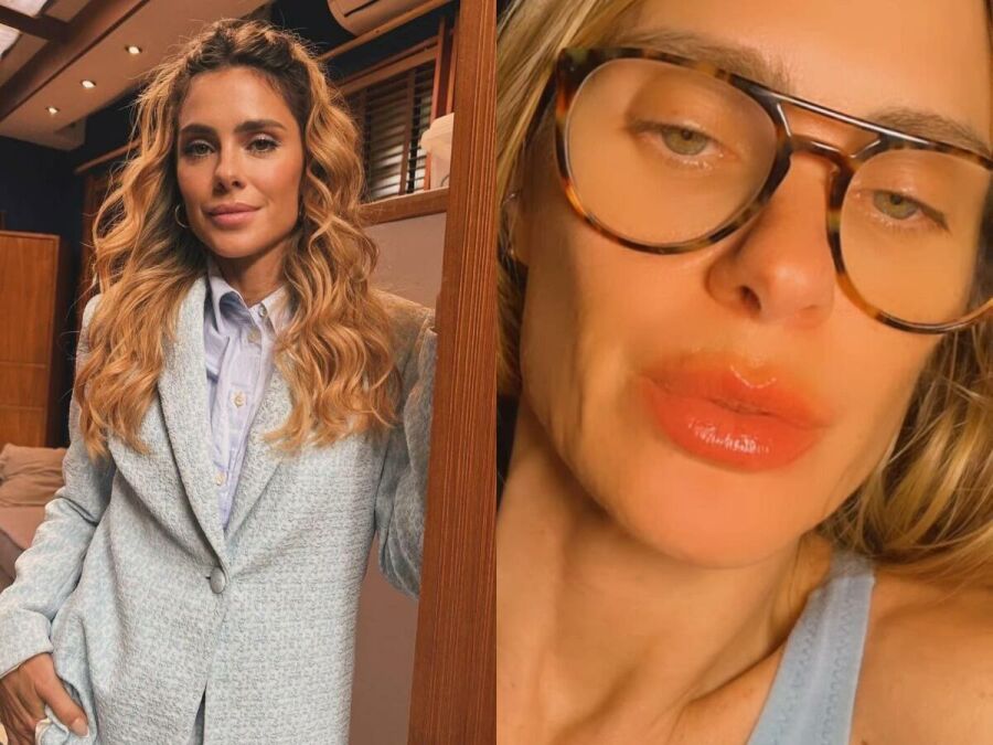 Imagem Alergia_Boca_Carolina