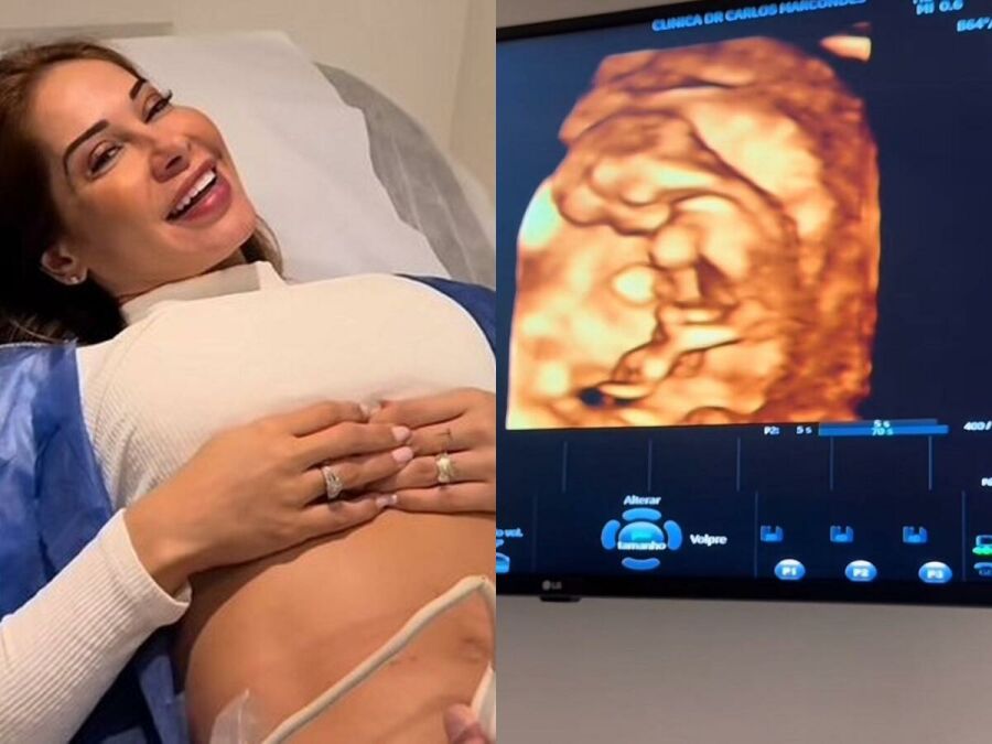 Imagem maíra-ultrassom-0