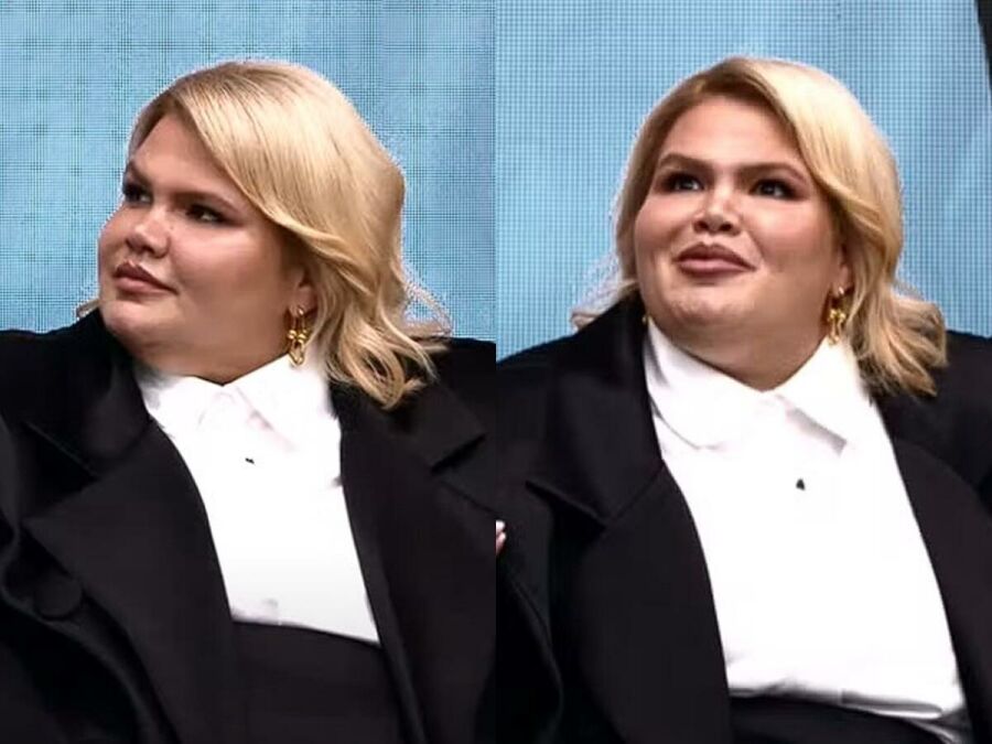 Imagem thais-carla-fala-cirurgia
