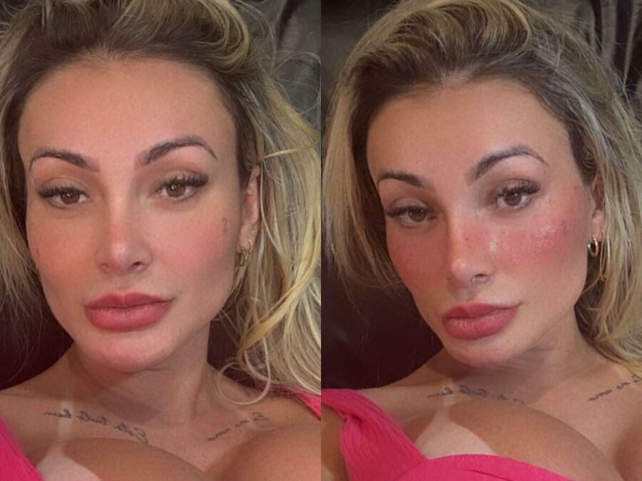 Imagem Antes-e-depois