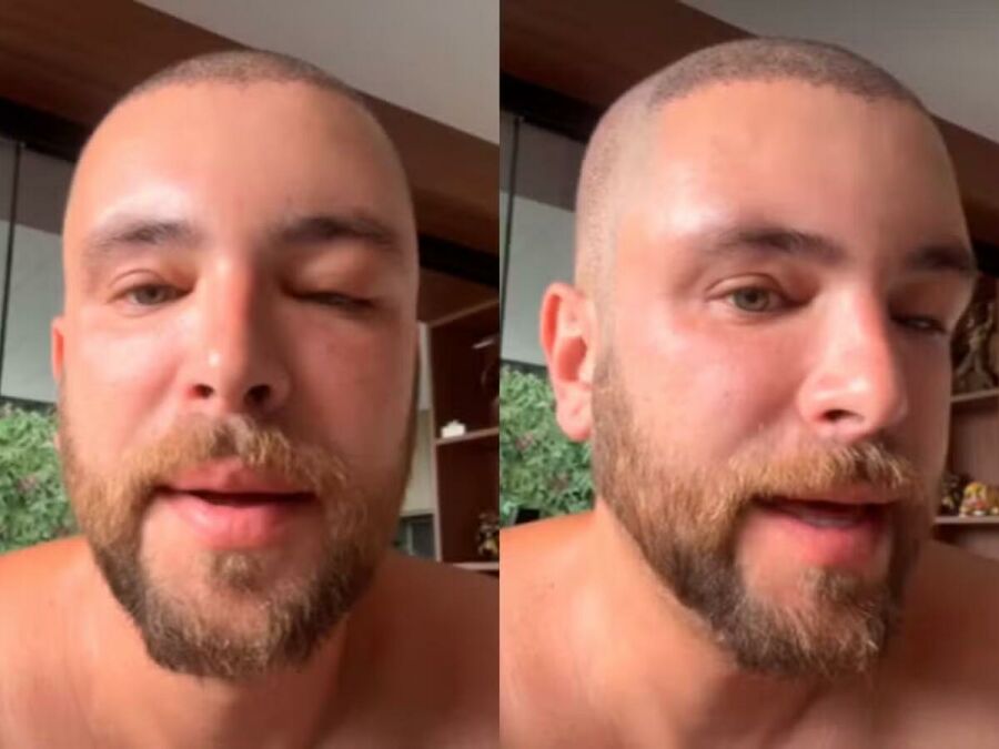 Imagem gustavo-marsengo-inchado