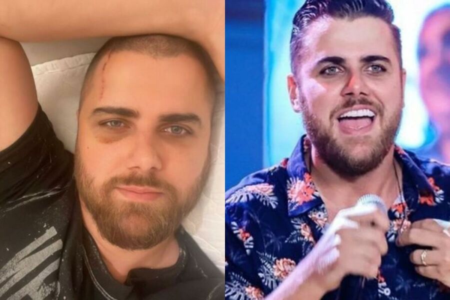 Imagem ze-neto-cicatriz