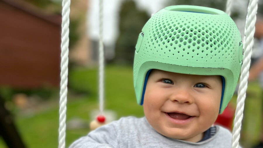Imagem bebe-com-capacete-para-plagiocefalia