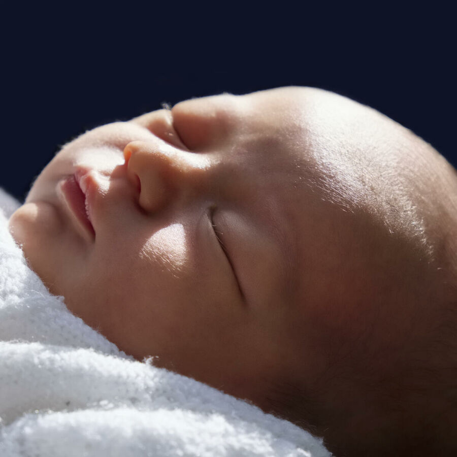 Imagem close-cranio-de-bebe-recem-nascido