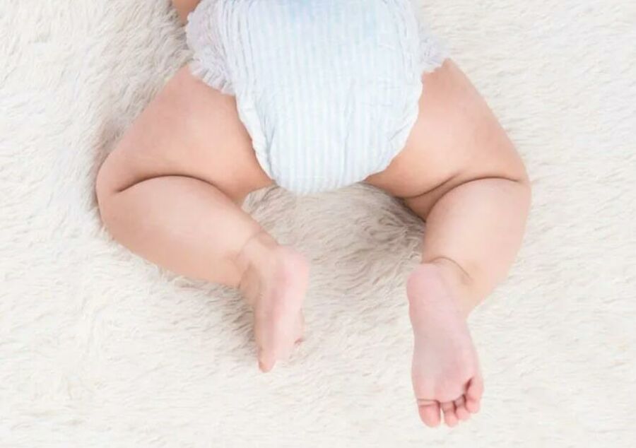 Imagem quadril-do-bebe