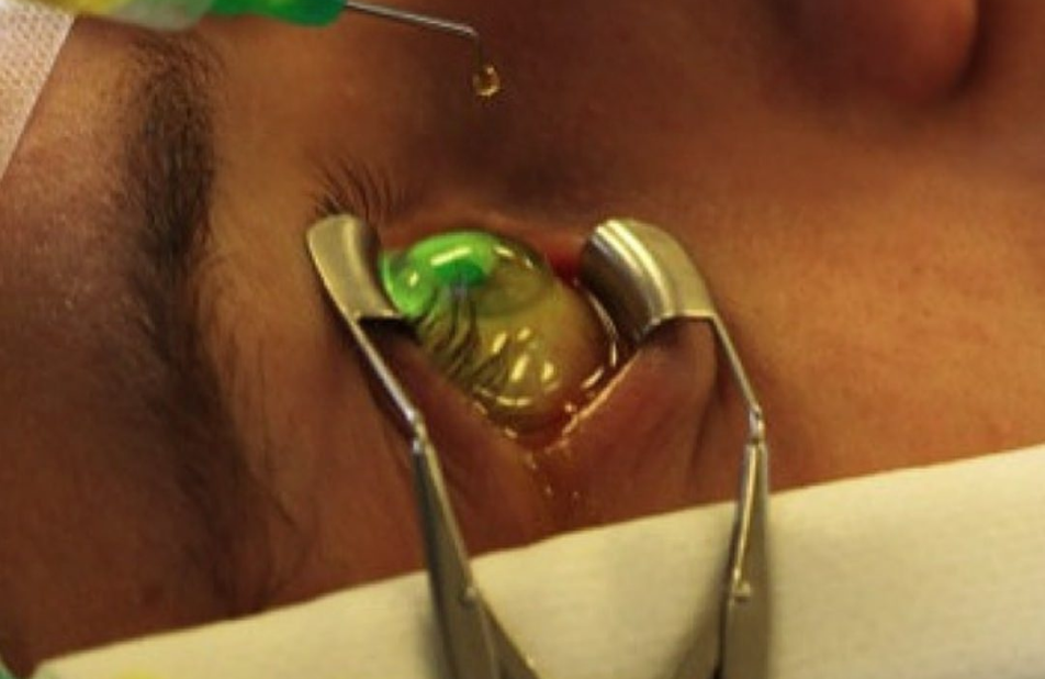 Imagem crosslinking