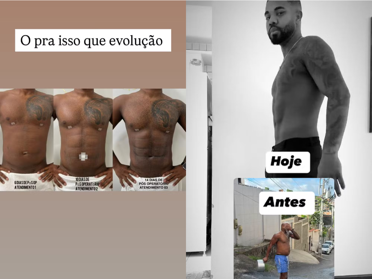 Imagem antes-e-depois-davi-brito
