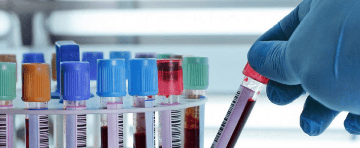 Imagem principal de Preço do aparelho de hemogasometria veterinária
