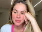 Imagem da notícia Bárbara Evans faz desabafo e expõe problema delicado de saúde: “Pior dor da minha vida”