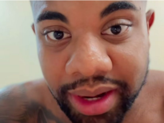 Imagem da notícia Davi Brito se arrepende de lentes de contato nos dentes e faz ajuste após críticas: "Estava muito grande"