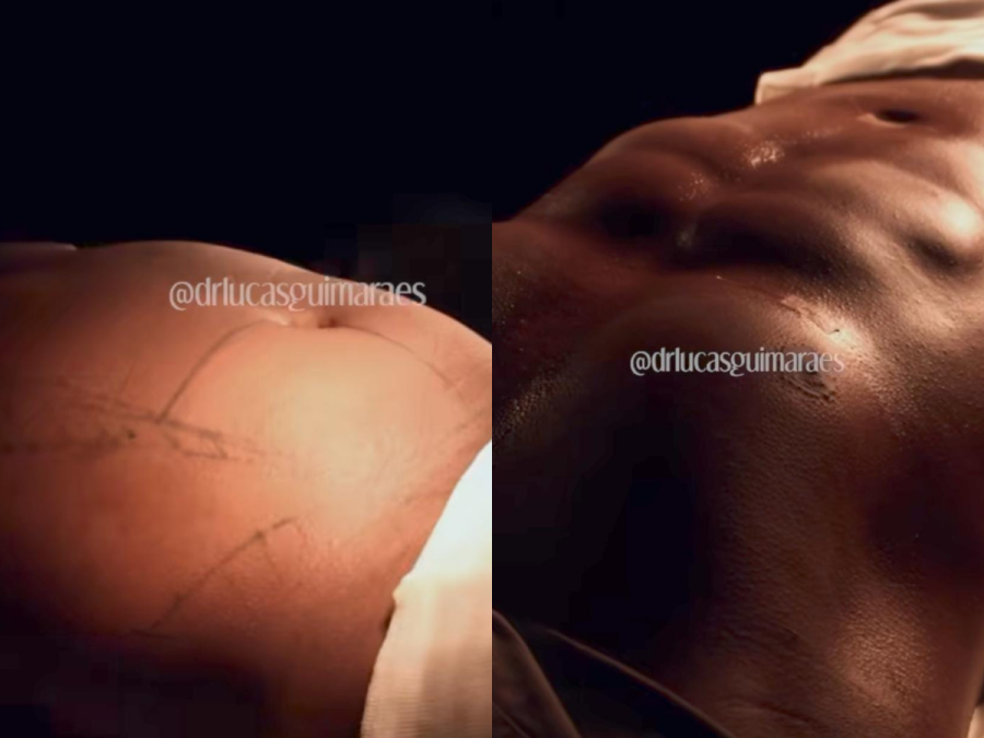 Imagem antes-depois
