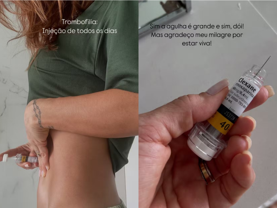 Imagem maira-injecao-diagnostico