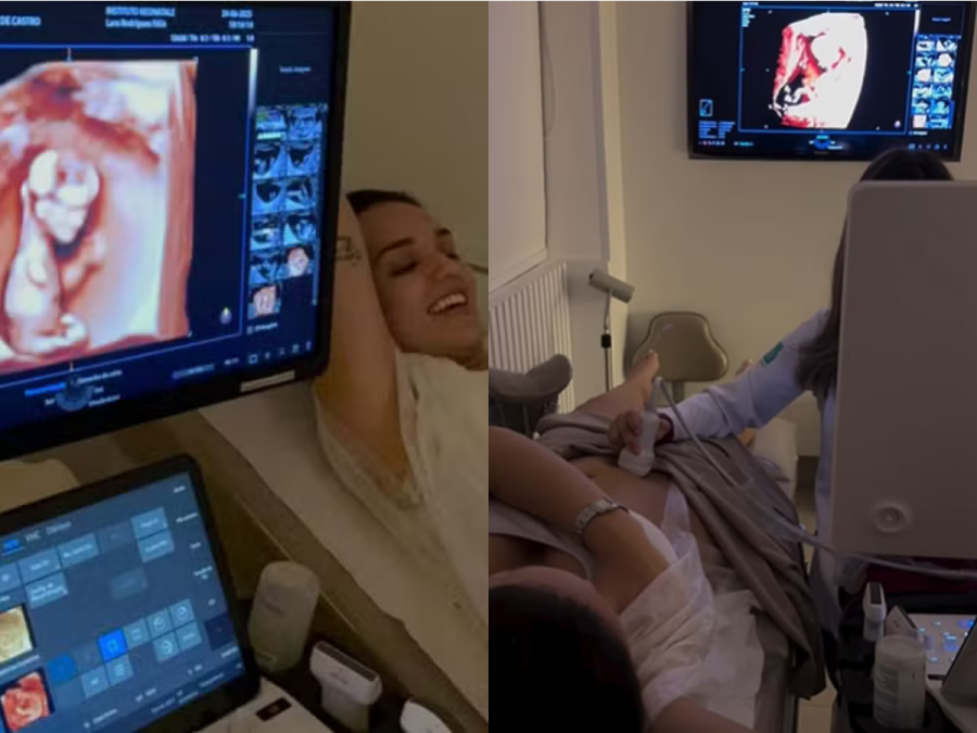 Imagem ultrassom-rafa-kalimann