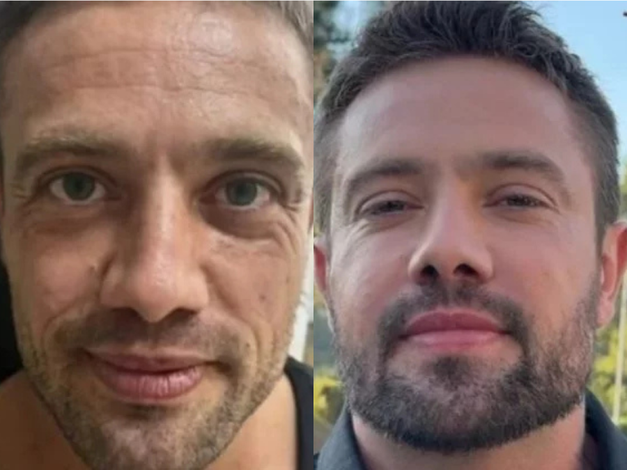 Imagem antes-e-depois