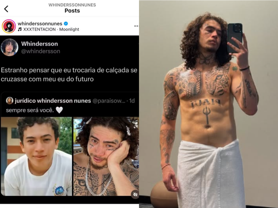 Imagem antes-depois-whindersson-nunes