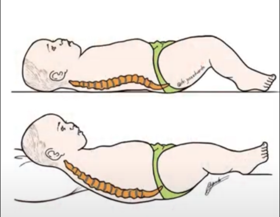 Imagem imagem-coluna-bebe-travesseiro