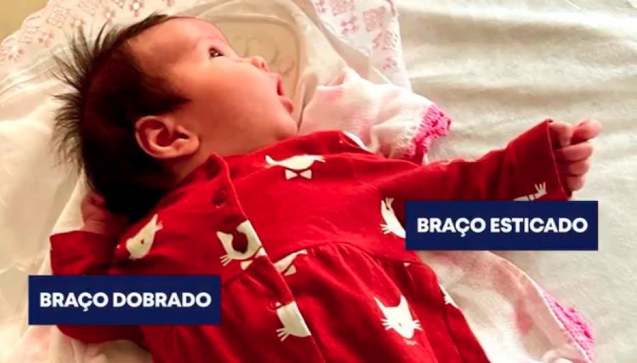 Imagem bebe-esgrimista-posicao-superior