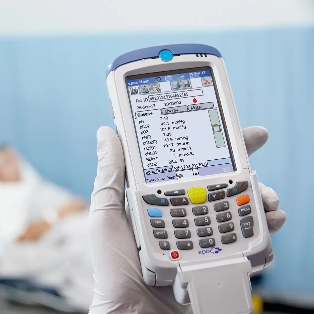Imagem principal de epoc® Siemens - Medidor Portátil de Gasometria pO2, pCO2, pH