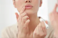 Imagem principal do artigo Nem todo mundo precisa de preenchimento labial: conheça a alternativa que valoriza o volume natural dos lábios