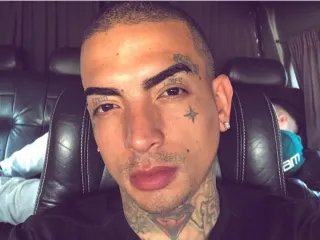 Imagem da notícia MC Guimê faz harmonização facial e mostra resultado na web; veja o antes e depois