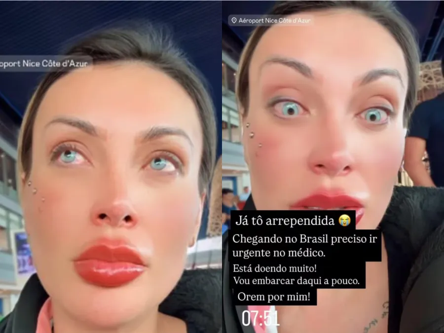 Imagem stories-urach