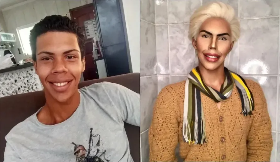 Imagem ken-antes-e-depois